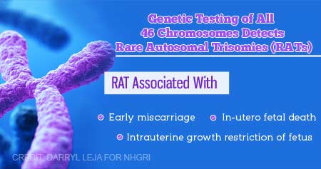 Genetic Testing During Prenatal Testing Uncovers Rare Autosomal Trisomies